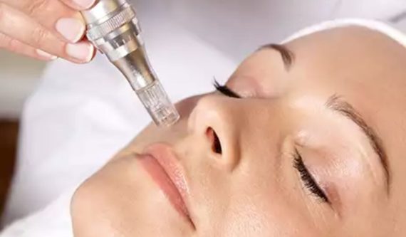 dermapen